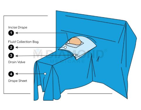 Cesarean LSCS Drape